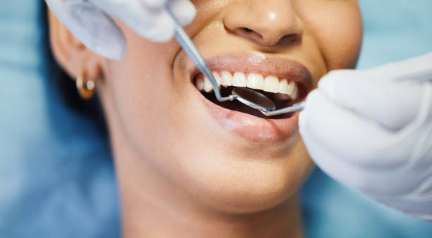 Reliable CA Emergency Dental Service Solutions